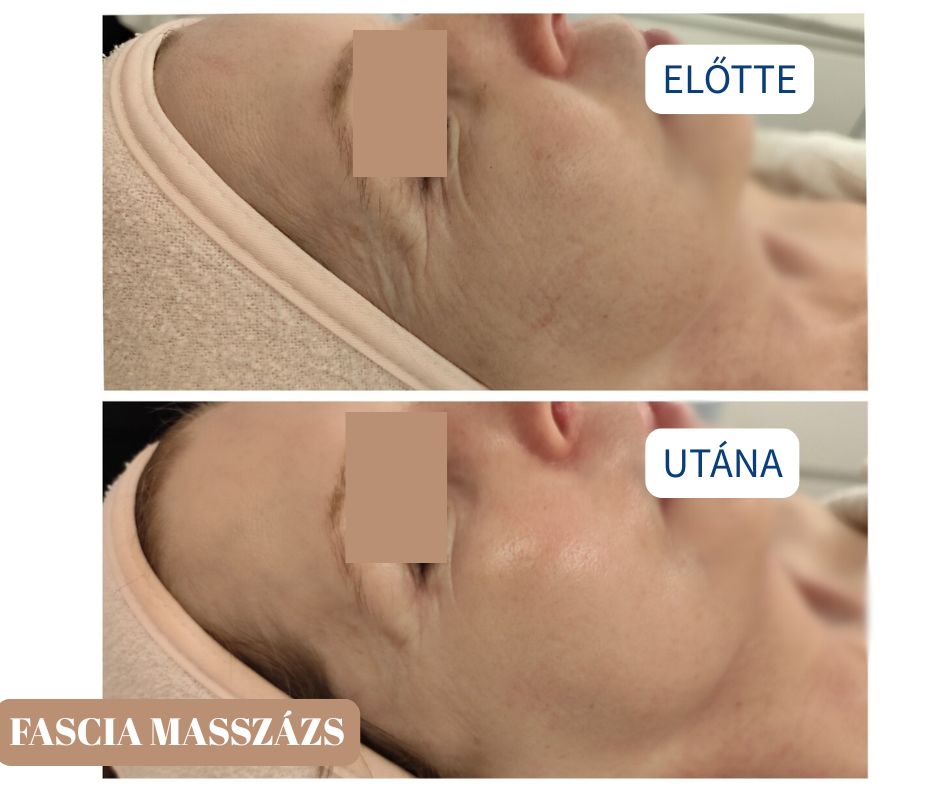 fascia masszázs budapest mester kozmetikus