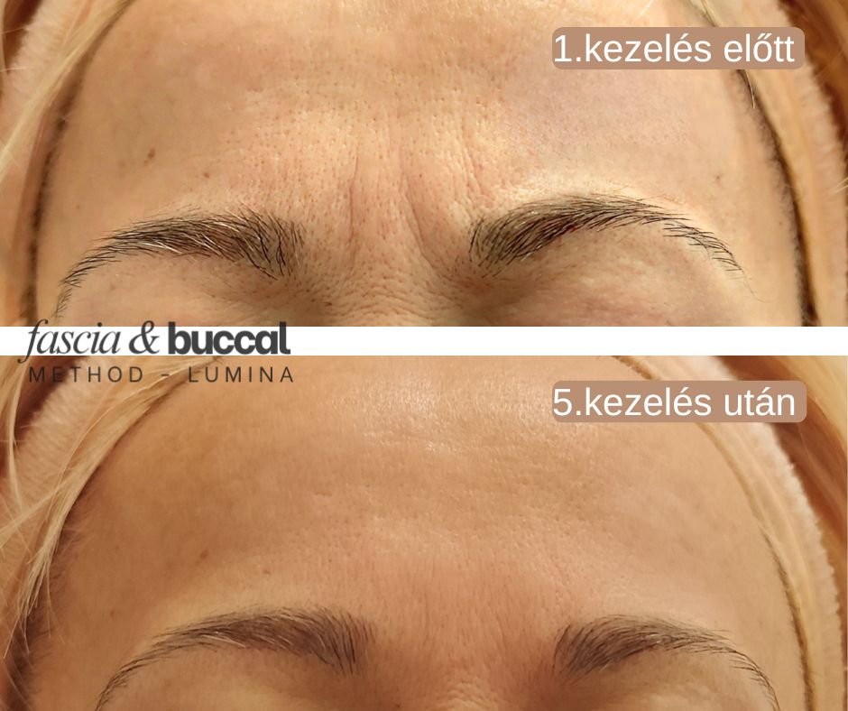 lumina fascia masszazs